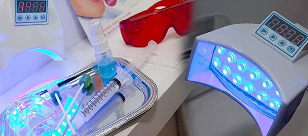 photo machine blanchiment dentaire